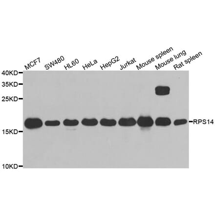 Western blot - RPS14 antibody from Signalway Antibody (39134) - Antibodies.com