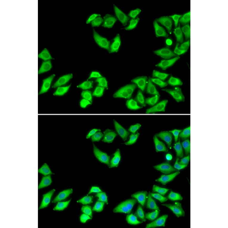 Immunofluorescence - RPS14 antibody from Signalway Antibody (39134) - Antibodies.com