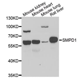 Western blot - SMPD1 antibody from Signalway Antibody (39147) - Antibodies.com