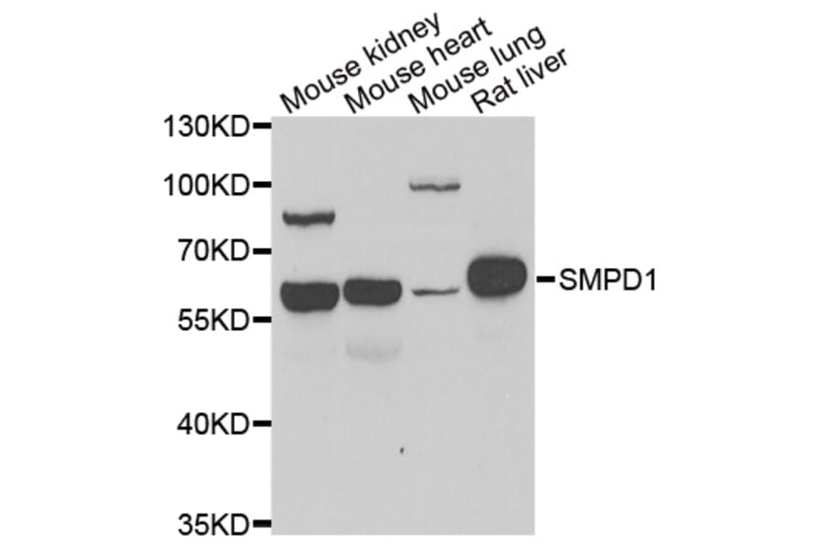 Western blot - SMPD1 antibody from Signalway Antibody (39147) - Antibodies.com