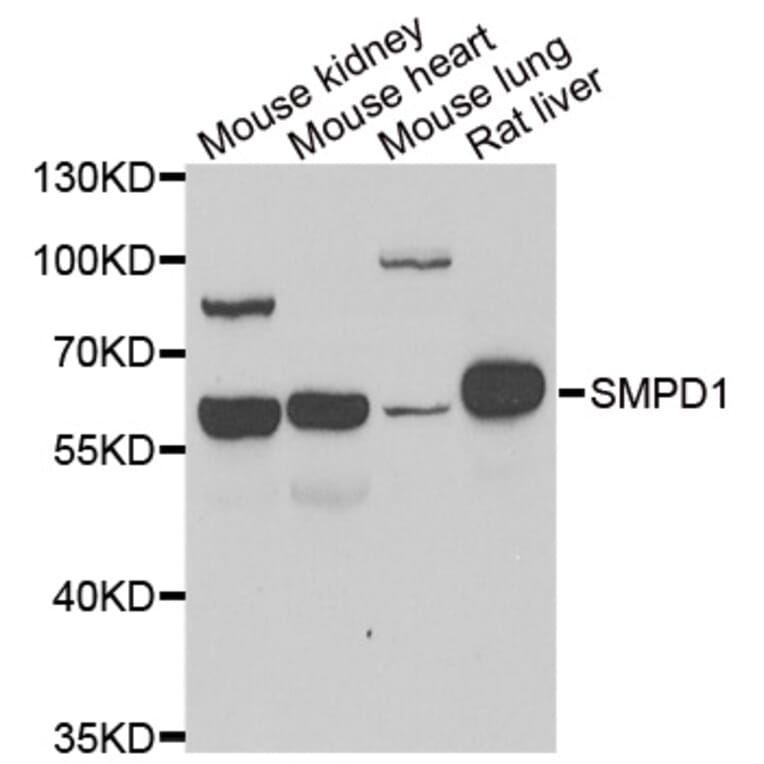 Western blot - SMPD1 antibody from Signalway Antibody (39147) - Antibodies.com