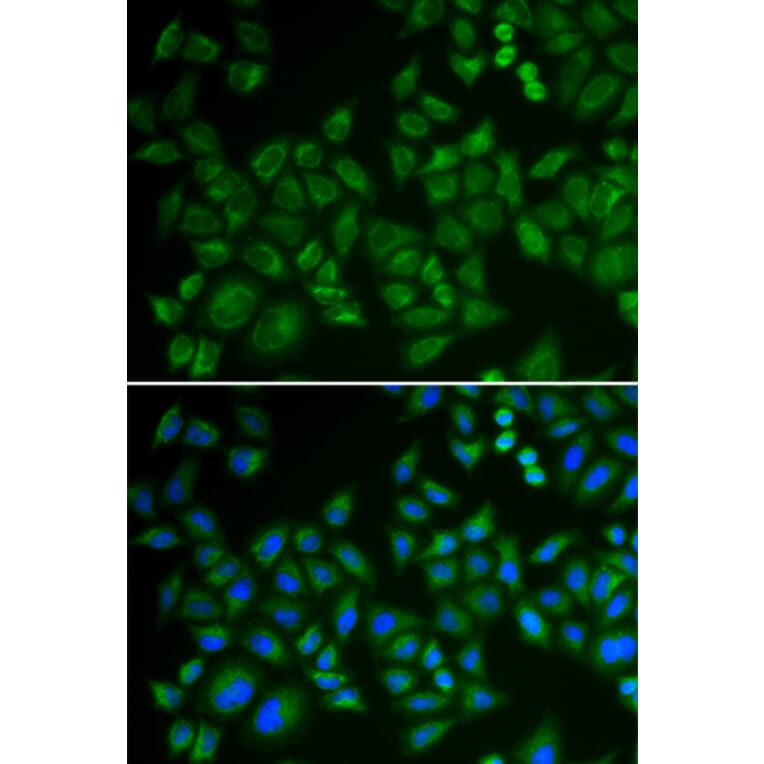 Immunofluorescence - SMPD1 antibody from Signalway Antibody (39147) - Antibodies.com