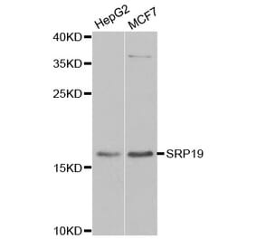Western blot - SRP19 antibody from Signalway Antibody (39152) - Antibodies.com
