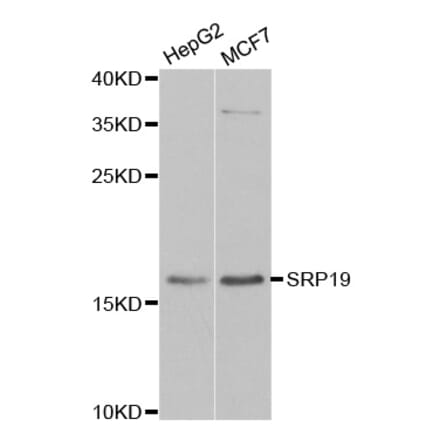Western blot - SRP19 antibody from Signalway Antibody (39152) - Antibodies.com
