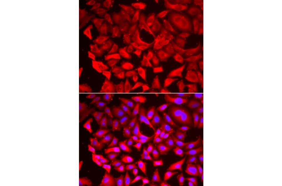 Immunofluorescence - SRP19 antibody from Signalway Antibody (39152) - Antibodies.com