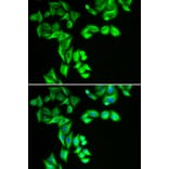 Immunofluorescence - STRN3 antibody from Signalway Antibody (39154) - Antibodies.com
