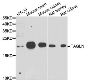 Western blot - TAGLN antibody from Signalway Antibody (39158) - Antibodies.com