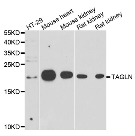 Western blot - TAGLN antibody from Signalway Antibody (39158) - Antibodies.com