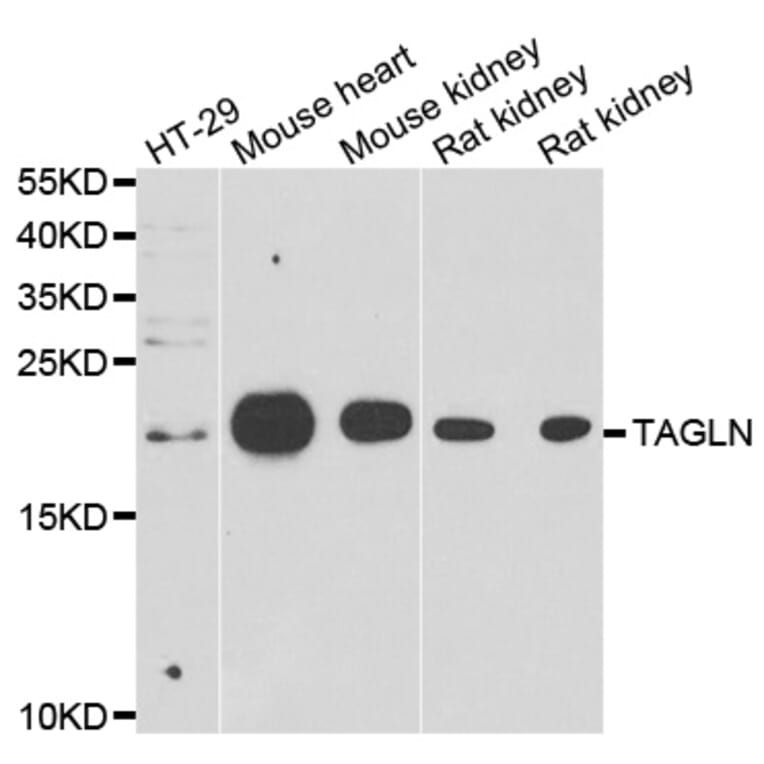 Western blot - TAGLN antibody from Signalway Antibody (39158) - Antibodies.com