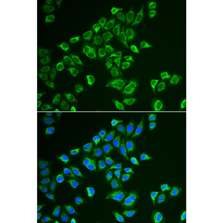 Immunofluorescence - TAGLN antibody from Signalway Antibody (39158) - Antibodies.com