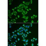 Immunofluorescence - TAGLN antibody from Signalway Antibody (39158) - Antibodies.com