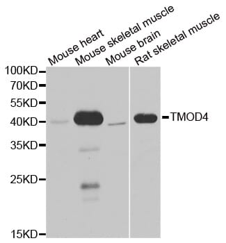 Western blot analysis of extracts of various cell lines, using TMOD4 antibody.