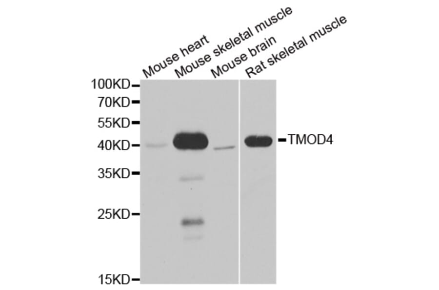 Western blot - TMOD4 antibody from Signalway Antibody (39168) - Antibodies.com