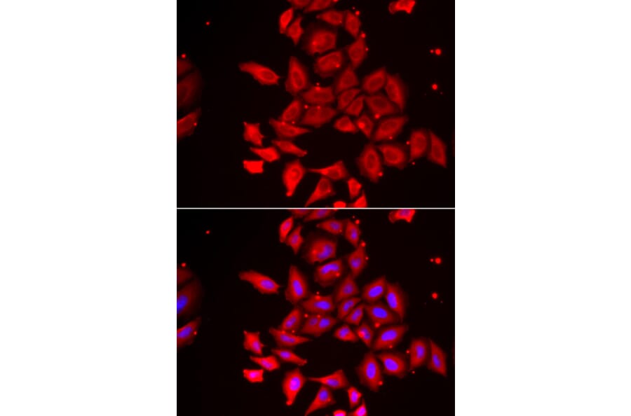 Immunofluorescence - TMOD4 antibody from Signalway Antibody (39168) - Antibodies.com