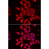 Immunofluorescence - TMOD4 antibody from Signalway Antibody (39168) - Antibodies.com