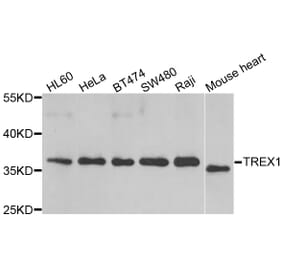 Western blot - TREX1 antibody from Signalway Antibody (39174) - Antibodies.com