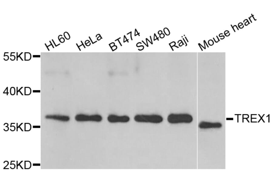 Western blot - TREX1 antibody from Signalway Antibody (39174) - Antibodies.com