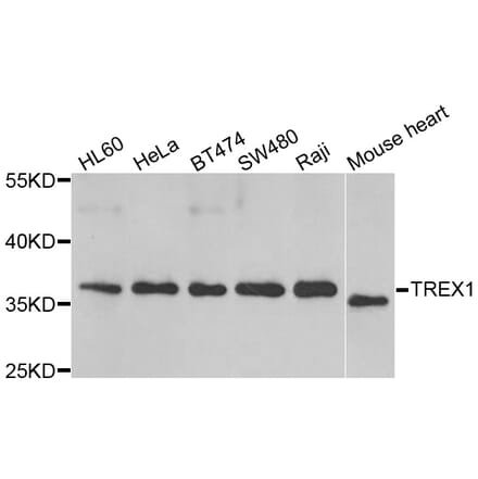 Western blot - TREX1 antibody from Signalway Antibody (39174) - Antibodies.com