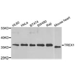 Western blot - TREX1 antibody from Signalway Antibody (39174) - Antibodies.com