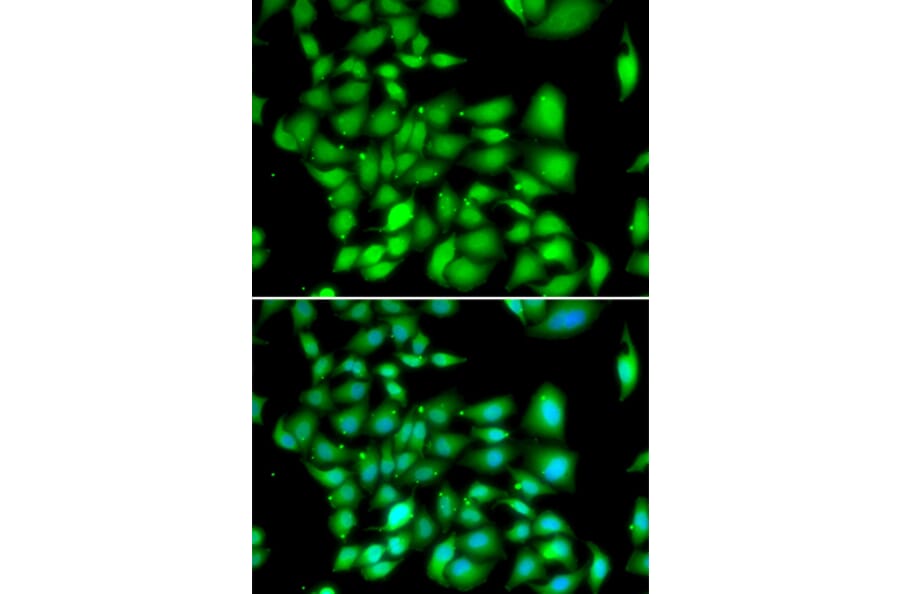 Immunofluorescence - TREX1 antibody from Signalway Antibody (39174) - Antibodies.com