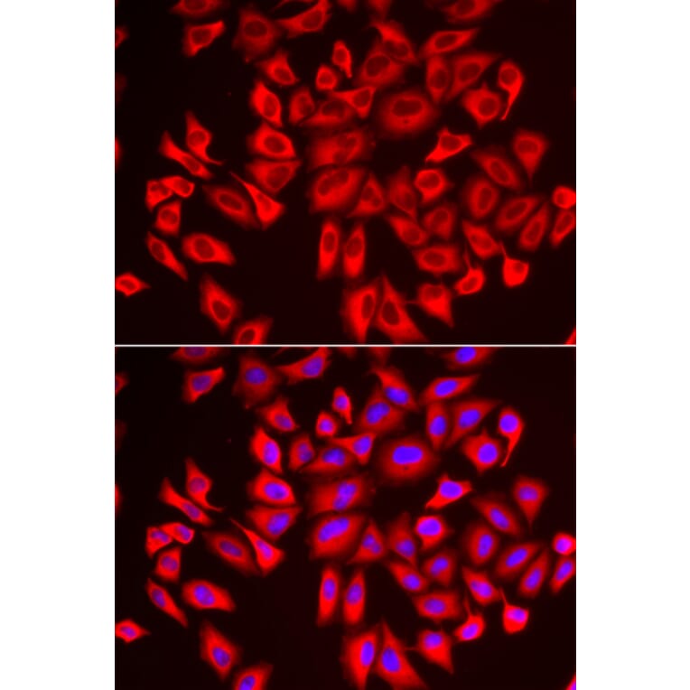 Immunofluorescence - DCAF7 antibody from Signalway Antibody (39181) - Antibodies.com