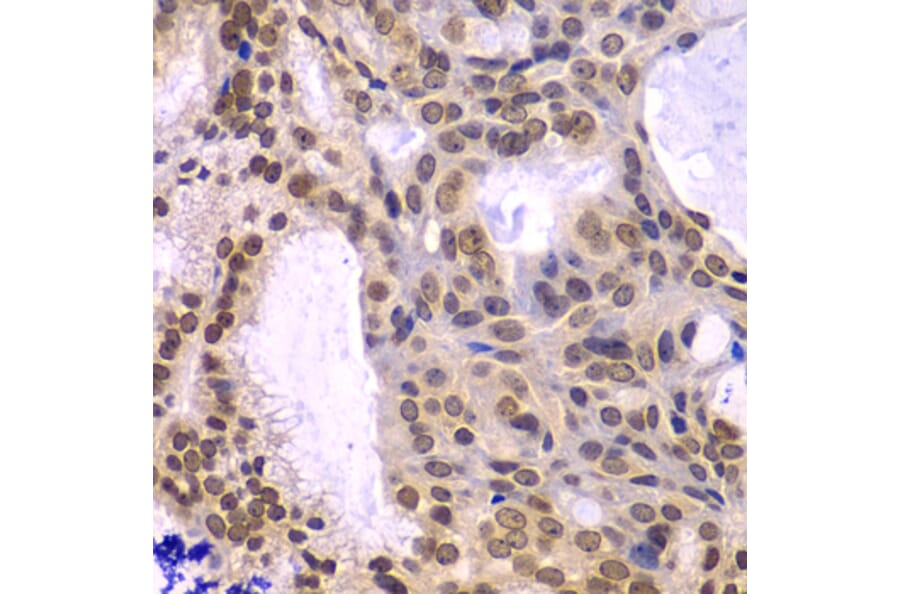 Immunohistochemistry - POLD3 antibody from Signalway Antibody (39190) - Antibodies.com