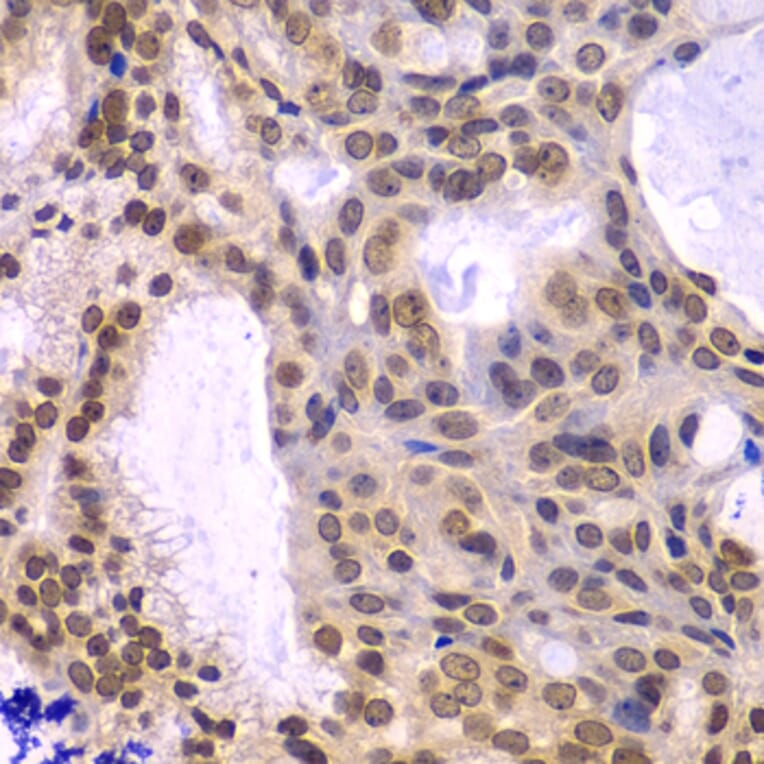 Immunohistochemistry - POLD3 antibody from Signalway Antibody (39190) - Antibodies.com