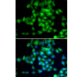 Immunofluorescence - SIRT3 antibody from Signalway Antibody (39196) - Antibodies.com
