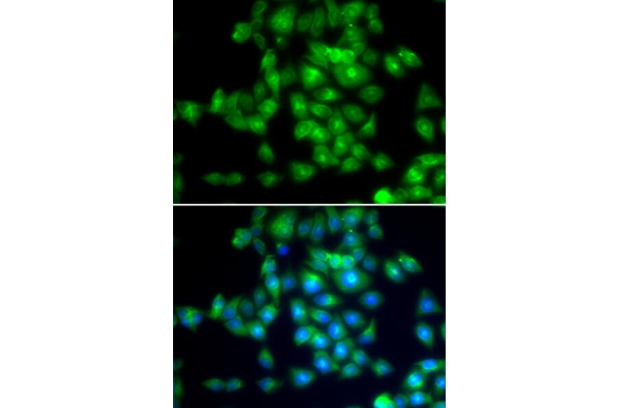 Immunofluorescence - SIRT3 antibody from Signalway Antibody (39196) - Antibodies.com