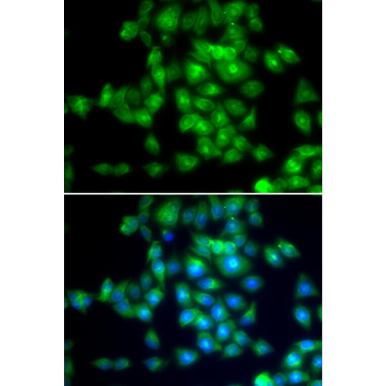 Immunofluorescence - SIRT3 antibody from Signalway Antibody (39196) - Antibodies.com