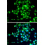 Immunofluorescence - SIRT3 antibody from Signalway Antibody (39196) - Antibodies.com