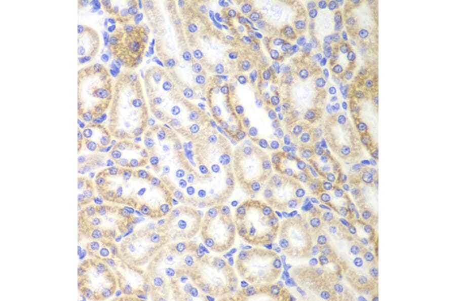 Immunohistochemistry - SIRT3 antibody from Signalway Antibody (39196) - Antibodies.com