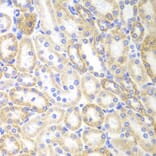 Immunohistochemistry - SIRT3 antibody from Signalway Antibody (39196) - Antibodies.com
