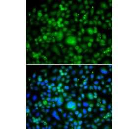 Immunofluorescence - SMYD3 antibody from Signalway Antibody (39197) - Antibodies.com
