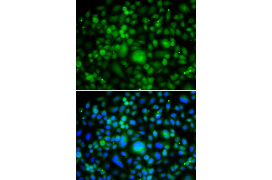 Immunofluorescence - SMYD3 antibody from Signalway Antibody (39197) - Antibodies.com