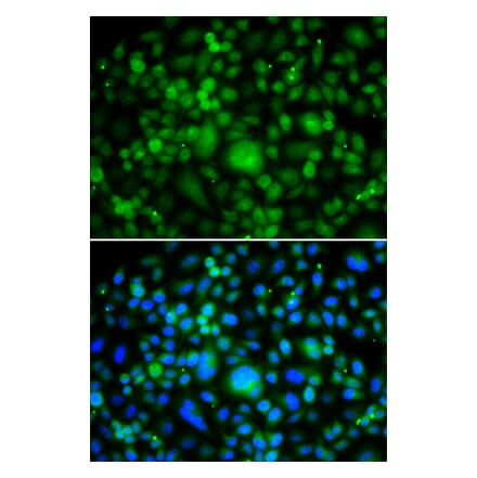 Immunofluorescence - SMYD3 antibody from Signalway Antibody (39197) - Antibodies.com