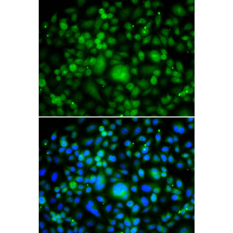 Immunofluorescence - SMYD3 antibody from Signalway Antibody (39197) - Antibodies.com