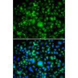 Immunofluorescence - SMYD3 antibody from Signalway Antibody (39197) - Antibodies.com