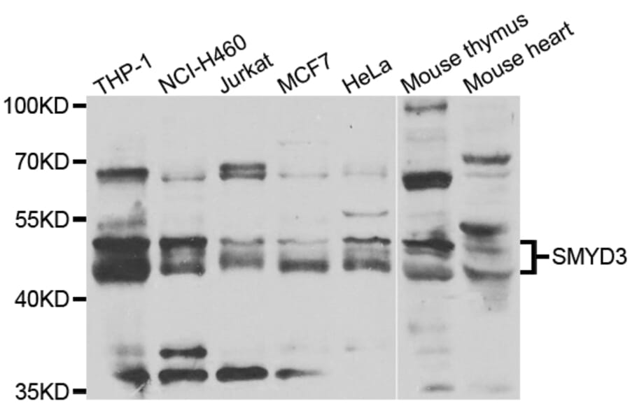 Western blot - SMYD3 antibody from Signalway Antibody (39197) - Antibodies.com