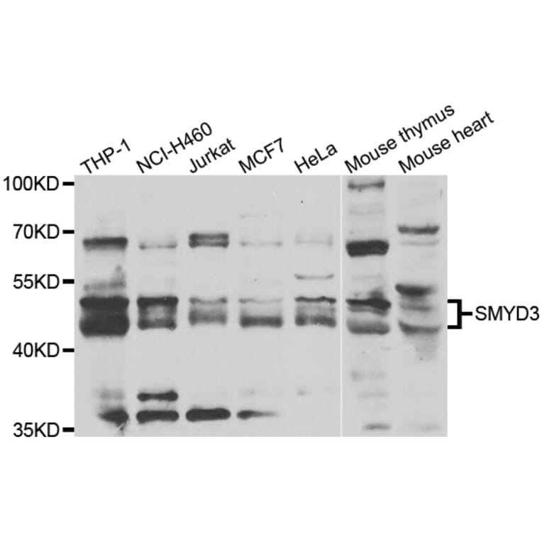 Western blot - SMYD3 antibody from Signalway Antibody (39197) - Antibodies.com