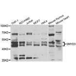 Western blot - SMYD3 antibody from Signalway Antibody (39197) - Antibodies.com