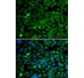 Immunofluorescence - SMYD4 antibody from Signalway Antibody (39198) - Antibodies.com