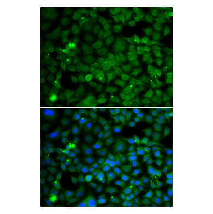 Immunofluorescence - SMYD4 antibody from Signalway Antibody (39198) - Antibodies.com