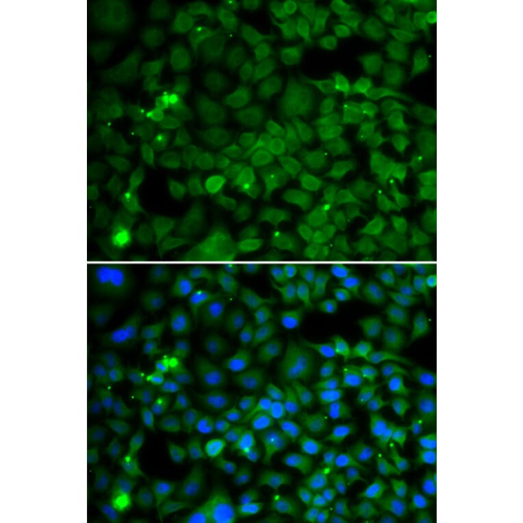 Immunofluorescence - SMYD4 antibody from Signalway Antibody (39198) - Antibodies.com