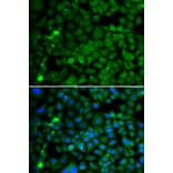 Immunofluorescence - SMYD4 antibody from Signalway Antibody (39198) - Antibodies.com