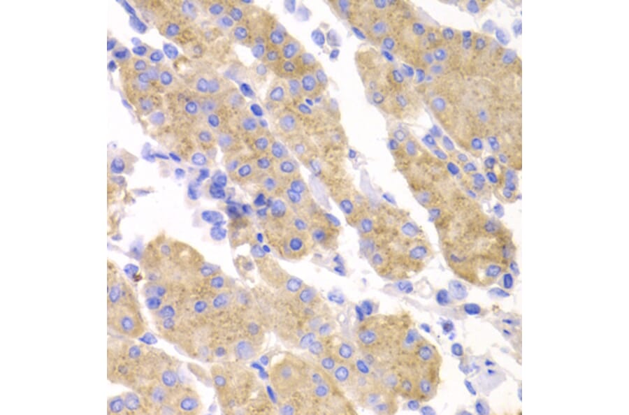 Immunohistochemistry - SMYD4 antibody from Signalway Antibody (39198) - Antibodies.com