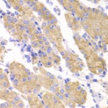 Immunohistochemistry - SMYD4 antibody from Signalway Antibody (39198) - Antibodies.com