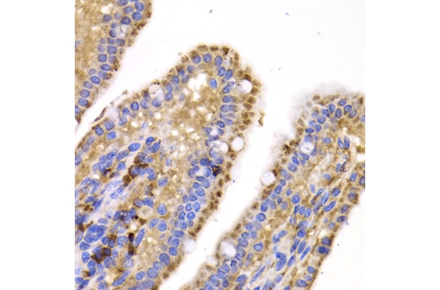 Immunohistochemistry - SMYD4 antibody from Signalway Antibody (39198) - Antibodies.com