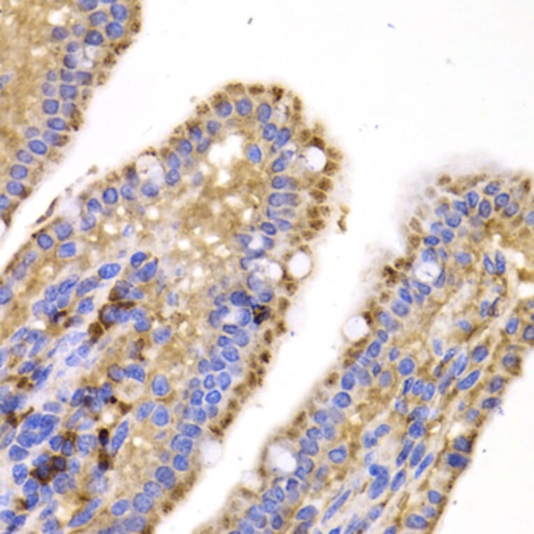 Immunohistochemistry - SMYD4 antibody from Signalway Antibody (39198) - Antibodies.com