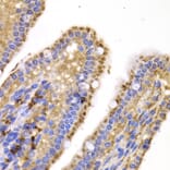 Immunohistochemistry - SMYD4 antibody from Signalway Antibody (39198) - Antibodies.com